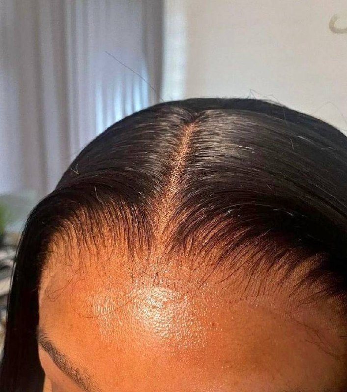 Close-up of a lace frontal installation showing a neat centre part and laid baby hairs